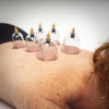 Cupping Set 6 pcs cupping massage therapy